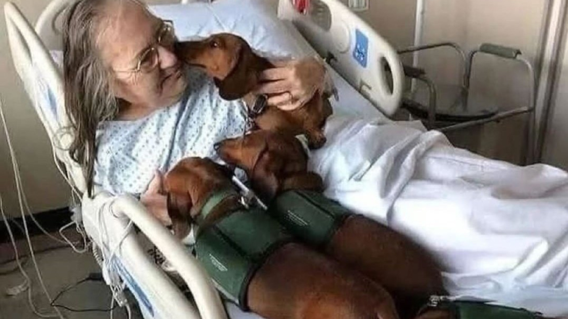 a woman in a hospital bed with three therapy dachshunds